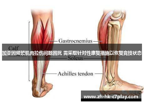 加亚因频繁肌肉拉伤问题困扰 需采取针对性康复措施以恢复竞技状态